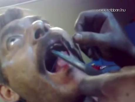 Orosz fogorvos vicces videó